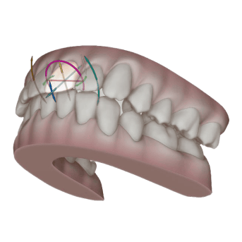 3D image of teeth and gums