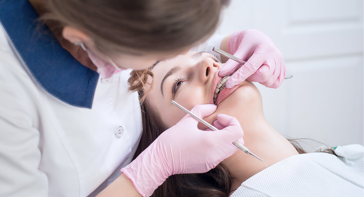 Summer is a Great Time to Get Braces and Straighten Teeth